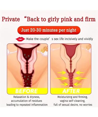 Alkyne Anniecare Instant Anti-Itch Detox Slimming & Vaginal Tightening Capsules (2 Bags) - Natural Repair Formula - Buy Online on GoSupps.com
