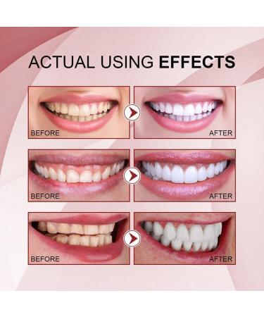 SP-4 Probiotic Rapid Whitening Toothpaste Fresh Breathe Whitening and Stain Removal Toothpaste Deep Cleaning Toothpaste Prevents Tartar - Buy Online on GoSupps.com
