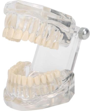 Transparent Acrylic Tooth Model - Dental Teaching Tool for Simulation & Pathological Repair | International Shipping - Buy Online on GoSupps.com