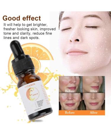 Natudeco 10ml Vitamin C Serum Whitening Face Essence Moisturizing Serum Skin Care Treatment for Facial Firming Hydrating Whitening Skin Dark Spot Remover - Buy Online on GoSupps.com