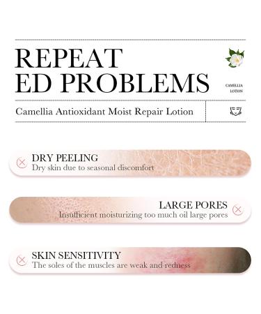 BIOAQUA Camellias Anti-Oxidation Moisturizing Repair Lotion 100ml - Deep Nourishing Skin Care for Rejuvenation & Smoothing | International Shipping Available - Buy Online on GoSupps.com