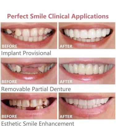 Fluktrix Temporary Dentures - Cosmetic Upper & Lower Lightening Artificial Teeth for a Confident Smile - 2 Pairs - Buy Online on GoSupps.com