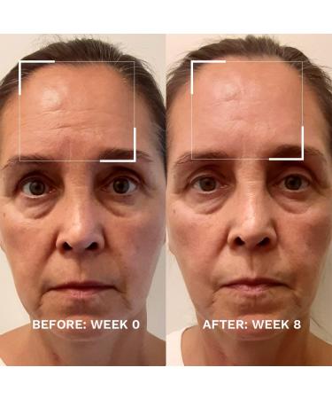 City Beauty Skin-Lifting Booster | Anti-Aging Serum | Lift & Tighten Sagging Skin | Peptides for Fine Lines & Wrinkles | Cruelty-Free Skin Care - Buy Online on GoSupps.com