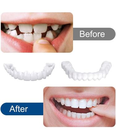 Buy Brigtviee 2 Pairs of False Teeth Veneers - Temporary Cosmetic Tooth Covers for Men & Women - Buy Online on GoSupps.com