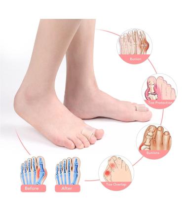 3 Pair Toe Separators 6PCS - SEBS/Nylon Material for Bunion Corrector and Toe Deformation Prevention - Buy Online on GoSupps.com