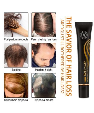 Hocossy Regrowth Organic Hair Serum Roller Set - Scalp Intense Hair Growth Treatment for Men & Women 20ml 3PCs - Natural Hair Care Solution - Buy Online on GoSupps.com