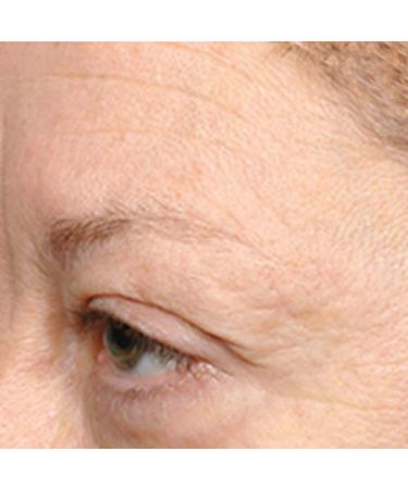 Nurse Jamie FormuL.A. Eye Cream - Revitalize Your Eyes | Anti-Aging & Hydrating Solution for Dark Circles - International Shipping Available - Buy Online on GoSupps.com