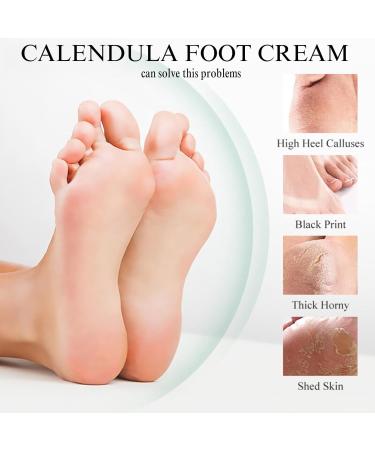 Calendula Foot Cream Cracked Heel Repair Cream Foot Moisturiser Cream Foot Cream for Very Dry Feet Feet Hard Skin Remover Foot Callus Remover Nourish Deeply Smoothing & Tender - Buy Online on GoSupps.com