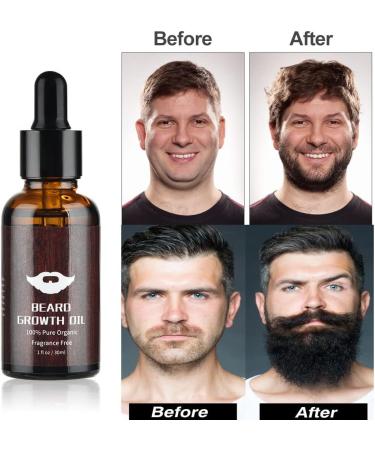 Beard Growth Kit for Men - Beard Roller, Oil, Balm, Styling Comb - Birthday & Fathers Gifts - Set A - Buy Online on GoSupps.com