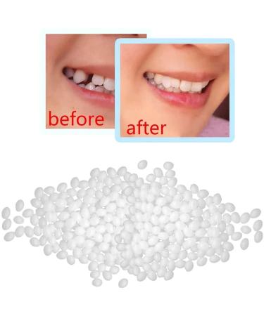Snap-On Veneers Teeth Kit - Solid False Teeth for Missing Denture Gaps - Temporary, Confidence-Boosting Solution with Tooth Adhesive - Includes Travel Brush Holder Cup - White, One Size - Buy Online on GoSupps.com