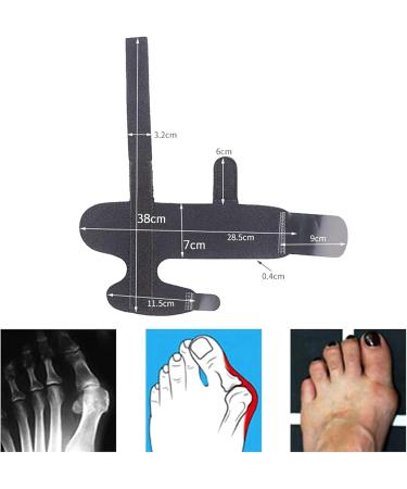 Buy Suloy Bunion Corrector - Orthopedic Rail with Metal Support | Relieve Great Toe Pain & Straighten Toes - Buy Online on GoSupps.com