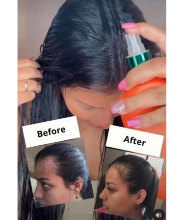 GOLD SPELL - Tonique Puissant Traitement Anti- Perte de Cheveux Puissant Tonique 250ml - Buy Online on GoSupps.com