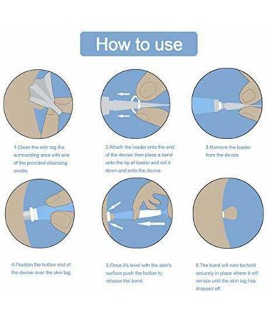 Auto Skin Tag Remover Kit - 20 Bands Warts Removal Device for Easy Skin Tag Removal | International Shipping Available - Buy Online on GoSupps.com