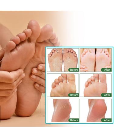 Sprays Pour Les Pieds Et Les Ongles 2 Pcs Produits De Soins Des Pieds Sprays S rum Ongles Pour La Croissance Et La Force Pour Hommes Et Femmes 30ml 0.5 ml (Lot de 2) - Buy Online on GoSupps.com