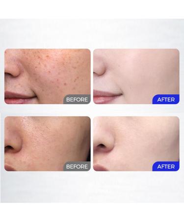 Facial lotion 100ml Portable Brightening Facial Lotion Hydrating Gel Moisturizer NonSticky for Sensitive Skin Daily and Night Use - Buy Online on GoSupps.com