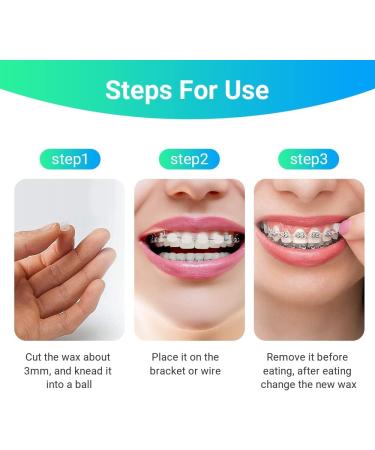 Braces Care Kit: Double-Sided Toothbrushes Interdental Brushes & Wax - 5-Piece Set for Optimal Oral Hygiene - Buy Online on GoSupps.com