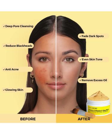 BACHERI Turmeric & Vitamin C Clay Mask for Blackheads, Acne, and Dark Spots - With Turmeric Extract for Glowing Skin, Pore Refinement, and Oil Control - Buy Online on GoSupps.com