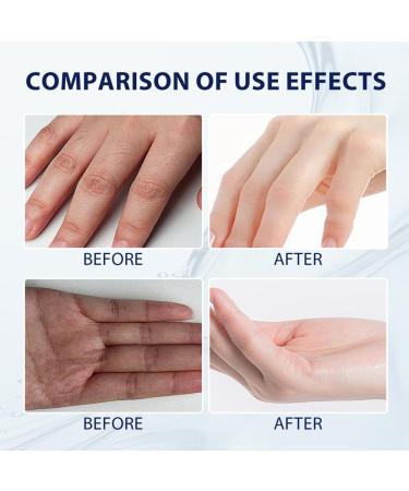 HAPPYWOO Aloe Vera Hand Gel Anti-dryness Moisturizing Hydrating and Repairing Cracked Hand Skin - Buy Online on GoSupps.com