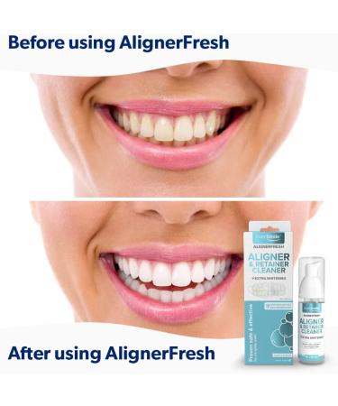 EverSmile AlignerFresh Extra Whitening Foam - Aligner Cleaner & Retainer Whitener - Buy Online on GoSupps.com