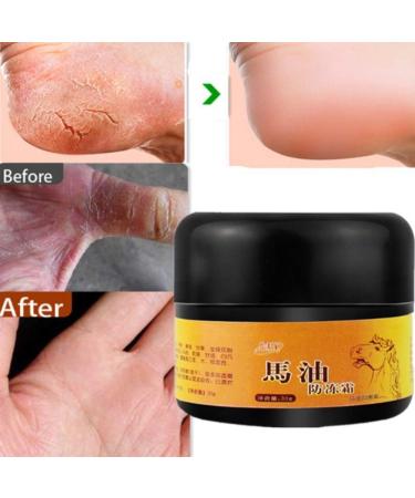 AllbestAye Foot Repair Cream - Heal Cracked Heels & Dry Feet | Moisturizing Callus Care for Soft Skin - 50g - Buy Online on GoSupps.com