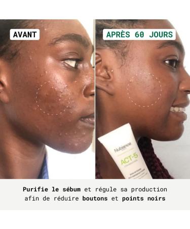  Nubiance NUBIANCE - ACT-5 2x30ml - Anti-acne face cream - Sebum regulation - For all skin types - Non-drying - Anti-blemish  - Buy Online on GoSupps.com