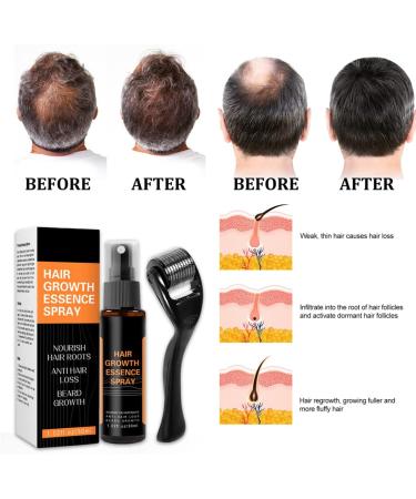 Spray Repousse Cheveux + Rouleau Repousse Cheveux Spray Repousse Cheveux Pour Hommes Femmes Spray Repousse Cheveux L'huile De Gingembre Stoppe La Chute Des Cheveux (Spray+Roller) - Buy Online on GoSupps.com
