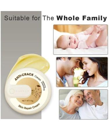 Suho Skin Healing Ointment for Cracked Heels & Dry Feet | Best Anti-Crack Hand & Foot Cream | Repair Calluses & Dead Skin - International Shipping - Buy Online on GoSupps.com