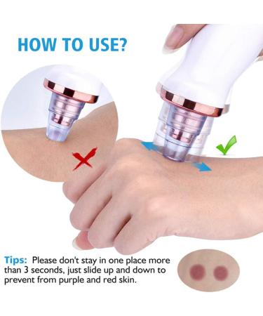 Benkeg Blackhead Remover - Electric Blackhead Suction Device with 5 in 1 Pimple Zit Comedone Extractor Tool Acne Removal kit Blackhead Remover Household Face Pore Cleaner Cosmetic Instrument White with 5pcs needles - Buy Online on GoSupps.com