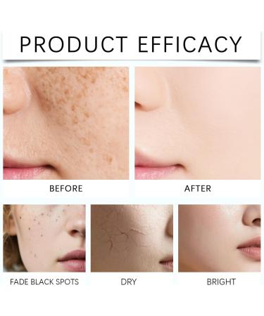 Cr me Hydratante Quotidienne For Le Visage Am liore La Texture De Peau R duit Les Imperfections Nourrit En Profondeur Et Adoucit For Un Teint Radieux - Buy Online on GoSupps.com