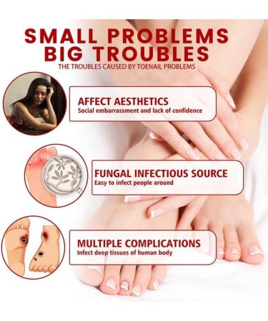 2023 La Nouvelle Huile de soulagement Rapide de l'onychomycose favorise Une Croissance des Ongles Plus Saine et Plus Forte 4pcs - Buy Online on GoSupps.com