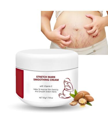IZBEAUVO Scar Removal Cream Stretch Mark Cream Pregnancy Scar Repair Cream Anti Stretch Mark Lotion Stretch Mark Smoothing Cream Repair Scar Cream Scar Remov E for Old Stretch Marks Vitamin E