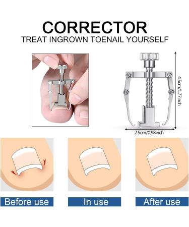 Professional Nail Scissors Toenail Set Robust Professional Nail Clippers Nail Clippers 12 Pieces Stainless Steel Toenail Clippers Repair for Thickness and Ingrown Toenails - Buy Online on GoSupps.com