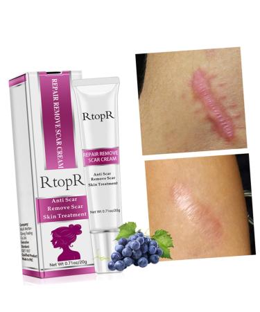 Healvian Scar Cream 3 Pcs Set - Skin Repair & Eraser - Blemish & Wrinkle Cream - Safe Scars Removal - Assorted Colors - 13.1x3cmx3pcs - Buy Online on GoSupps.com