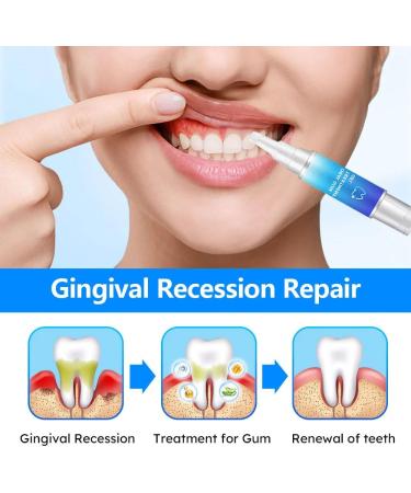 Remove Oral Gum Treatment Gel - Tooth Elevator Essence Pin & Protection - 3 PCs for Gum Residue Stains & Tartar Removal - Buy Online on GoSupps.com