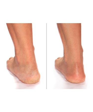 Advanced Clinicals Cracked Heel Cream 8 fl oz - Heal Rough & Dry Skin - Buy Online on GoSupps.com