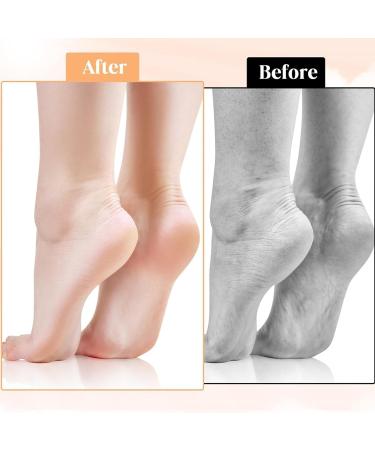 Silicone Moisture Socks for Dry Cracked Feet - Foot Care Spa Gel Socks for Women (Beige) - Buy Online on GoSupps.com