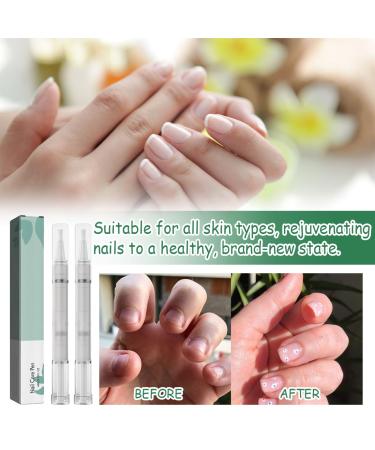 Hongecb Nail Care Pen - 2 PCs | Strengthen & Protect Your Nails | Health Routine Nail Care | Easy Application for Daily Use - Buy Online on GoSupps.com
