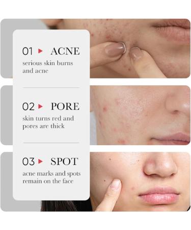 Friut Acid Face Serum for Acne Mark Salicylic Acid Anti Wrinkle Serum Fade Ance Mark & Shrink Pore Face Serum Hyaluronic Acid Acne Repair Serum for Sensitive Skin Smoothing Hyaluronic Serum-30ml - Buy Online on GoSupps.com