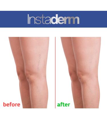 Vitamin K Cream with Arnica for Bruises, Spider Veins & Dark Circles - Moisturizer for Fine Lines, Puffiness & Wrinkles - Face & Body Repair - Buy Online on GoSupps.com