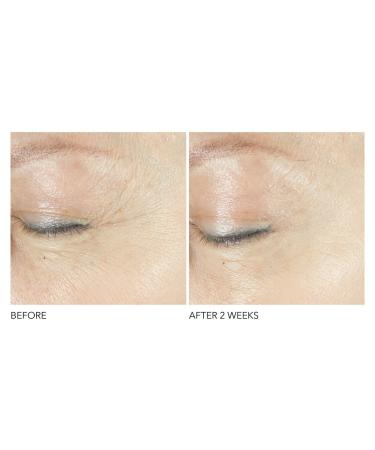 Dr. Dennis Gross Retinol + Ferulic Eye Serum for Firm Skin, Hydration, Wrinkle Reduction - 0.5 oz - Buy Online on GoSupps.com