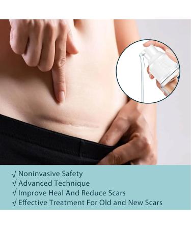 2Pcs 50ml Scar Gel with Allantoin & Vitamin E - Hydrate, Renew, Smoothing Stretch Marks Remover for Burn Surgery - Buy Online on GoSupps.com