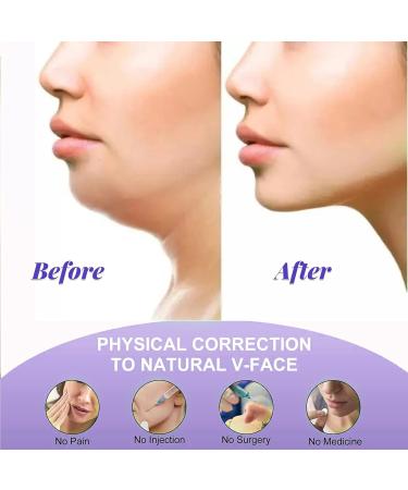 Double Chin Reducer & Face Lift Strap - Jawline Exerciser for V-Line Lifting | Slimming Solutions - Buy Online on GoSupps.com