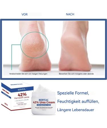 Cr me l'ur e avec 2 % d'acide salicylique pour les pieds - Pour talons secs et craquel s - Hydrate et limine les cors les callosit s les peaux mortes et adoucit les ongles des pieds - 140 ml - Buy Online on GoSupps.com