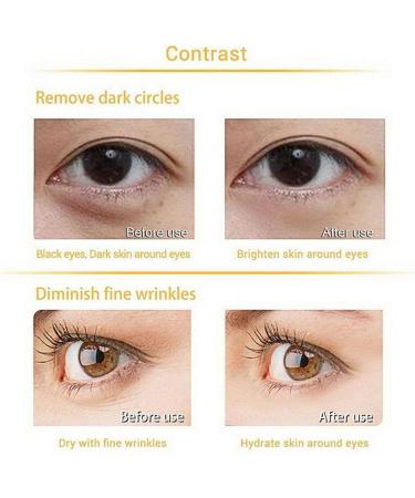 Silicone Eye Patch Combo Set Reusable Wrinkle Facial Forehead Facial Patch Removal Sticker Pad Eye - Buy Online on GoSupps.com