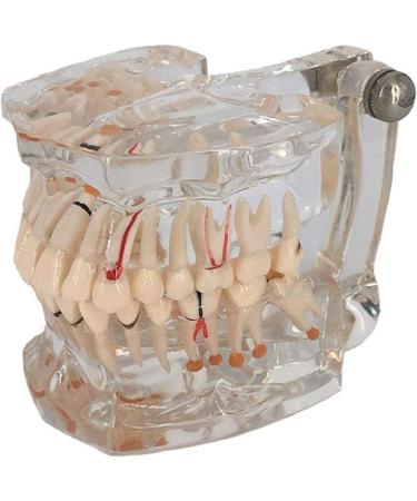 Buy DYTAH Transparent Teeth Model - Removable Pathological Tooth for Dental Training & Examination | International Shipping - Buy Online on GoSupps.com