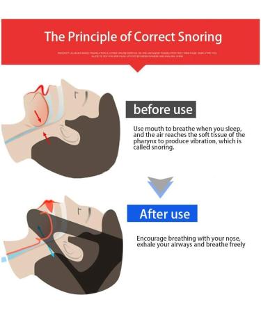 Effective Anti Snoring Chin Strap - Stop Snoring with this Cpap Chin Strap - Buy Online on GoSupps.com