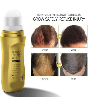 Hair Growth Promoting Oil Natural Organic Hair Growth Oil Essence Fast Natural Hair Growth for Thick and Fluffy Hair Growth  - Buy Online on GoSupps.com