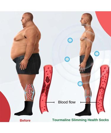 Alvo Feet Socks - Varicose Veins Acupressure Self-Heating Shaping Socks (3 Pairs Black) - Buy Online on GoSupps.com