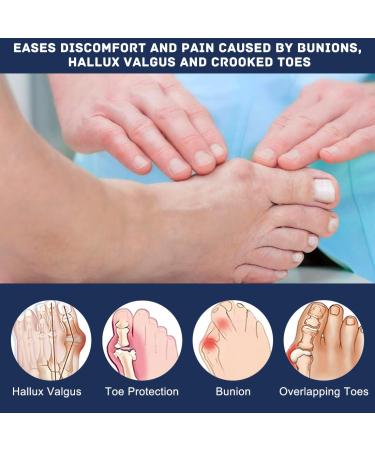 Buy Linxiu Hallux Valgus Correction Rail - Non-Slip Bunion Toe Spreader & Corrector Bandages (2 Pieces) for Day & Night Support - International Shipping Available - Buy Online on GoSupps.com