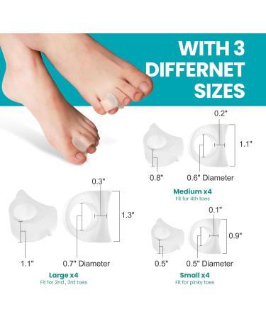Toe Separators for Overlapping Toes - Aloe Vera Toe Spacers for Hammer Toe Relief & Alignment | 12 Pack 3 Sizes - Promifun - Buy Online on GoSupps.com